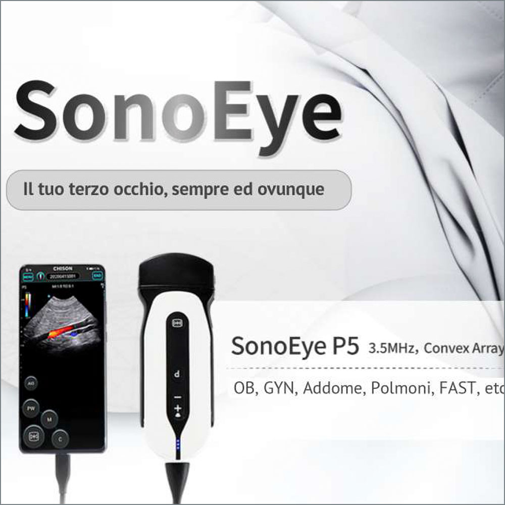 Ecografo palmare CHISON SonoEye P5 - immagine 4